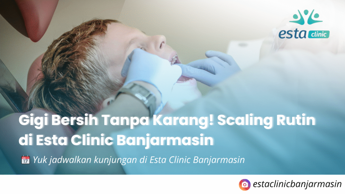 Gigi Bersih Tanpa Karang! Scaling Rutin di Esta Clinic Banjarmasin