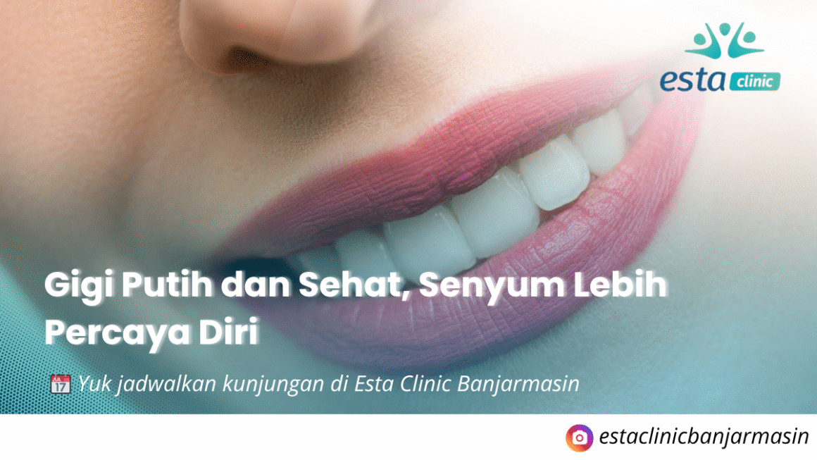 Dokter Gigi Banjarmasin – Promo Bleaching Rp 999K Dapat Scaling & Konsultasi Gratis di Esta Clinic!