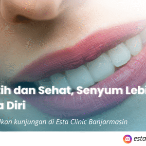 Dokter Gigi Banjarmasin – Promo Bleaching Rp 999K Dapat Scaling & Konsultasi Gratis di Esta Clinic!