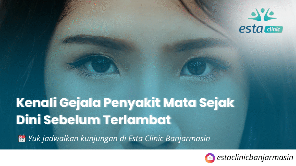 Kenali Gejala Penyakit Mata Sejak Dini Sebelum Terlambat