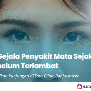 Kenali Gejala Penyakit Mata Sejak Dini Sebelum Terlambat