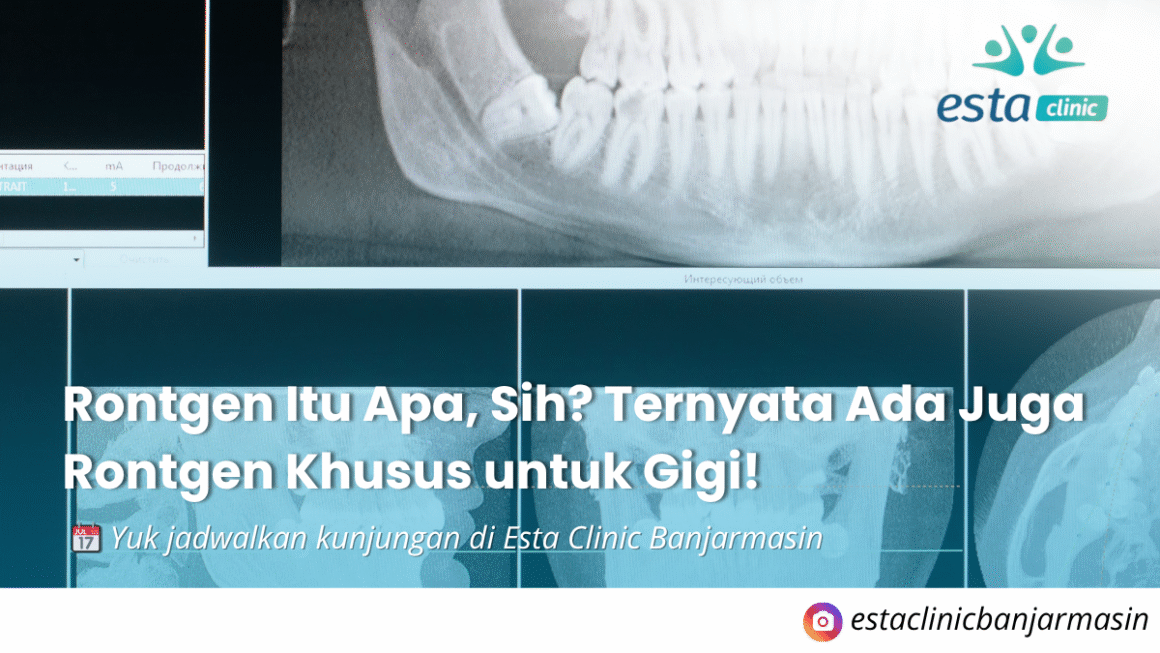 Kenapa Pemeriksaan Mata Rutin Penting, Meski Tidak Ada Keluhan (1) Rontgen Itu Apa, Sih? Ternyata Ada Juga Rontgen Khusus untuk Gigi!