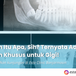 Kenapa Pemeriksaan Mata Rutin Penting, Meski Tidak Ada Keluhan (1) Rontgen Itu Apa, Sih? Ternyata Ada Juga Rontgen Khusus untuk Gigi!