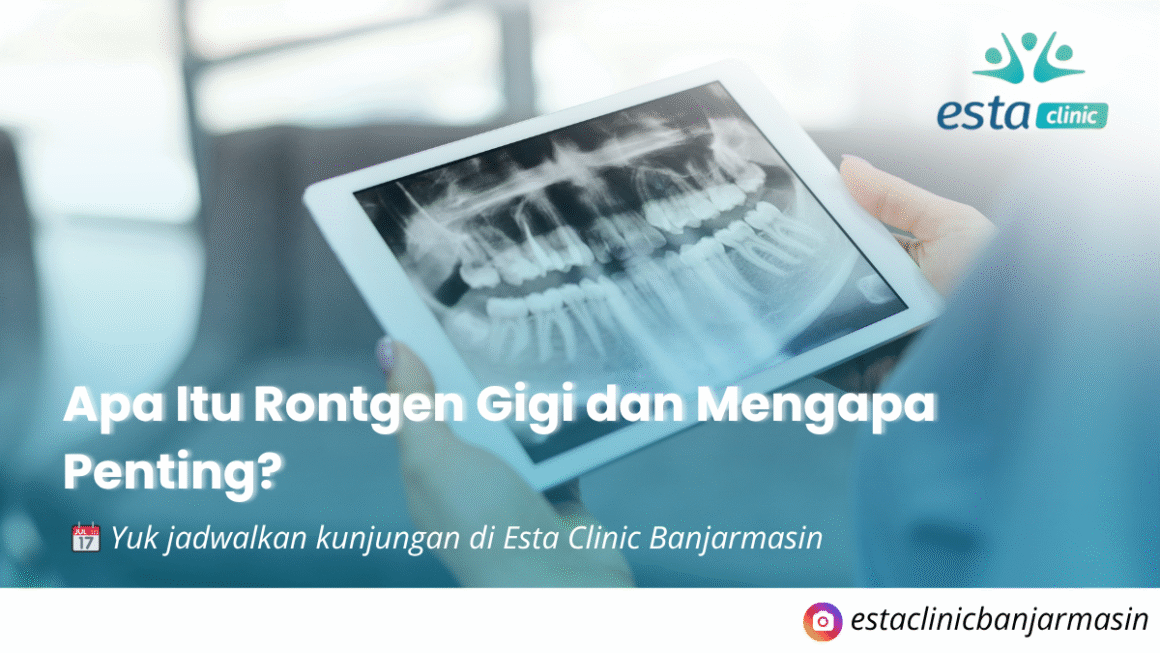 Rontgen Gigi di Banjarmasin – Langkah Penting Sebelum Perawatan Gigi