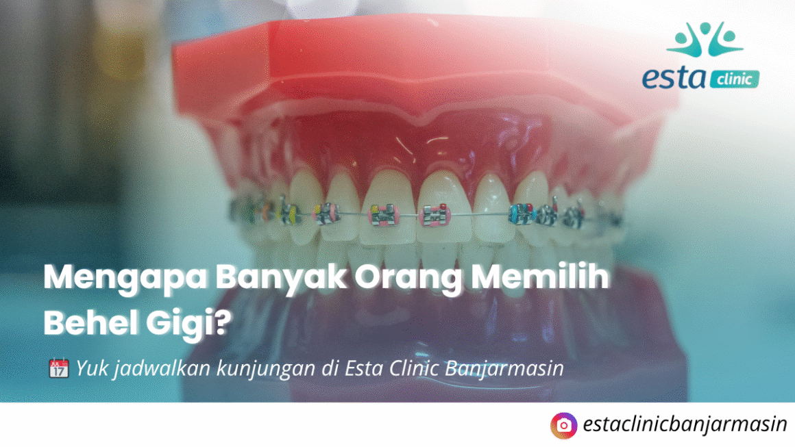 Perawatan Behel Gigi di Banjarmasin – Senyum Rapi & Percaya Diri Bersama Esta Clinic