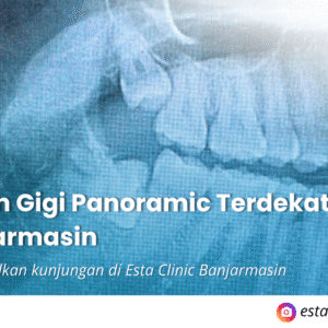 Rontgen Gigi Panoramic Terdekat di Banjarmasin Rontgen Gigi Panoramic Terdekat di Banjarmasin: Kenapa Perlu & Di Mana Bisa Dilakukan?