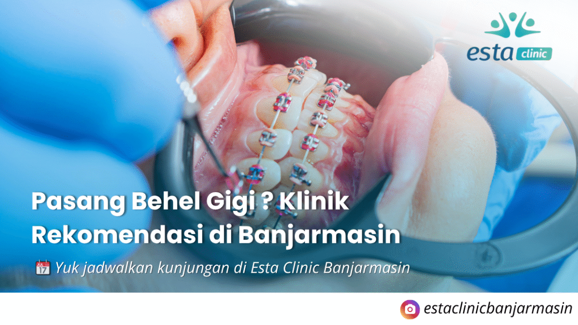 Kenapa Pemeriksaan Mata Rutin Penting, Meski Tidak Ada Keluhan (2) Pasang Behel Gigi di Banjarmasin: Manfaat, Proses, dan Klinik Rekomendasi