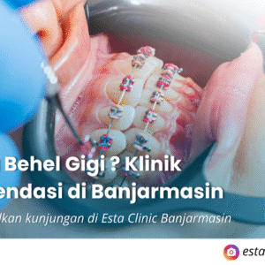 Kenapa Pemeriksaan Mata Rutin Penting, Meski Tidak Ada Keluhan (2) Pasang Behel Gigi di Banjarmasin: Manfaat, Proses, dan Klinik Rekomendasi