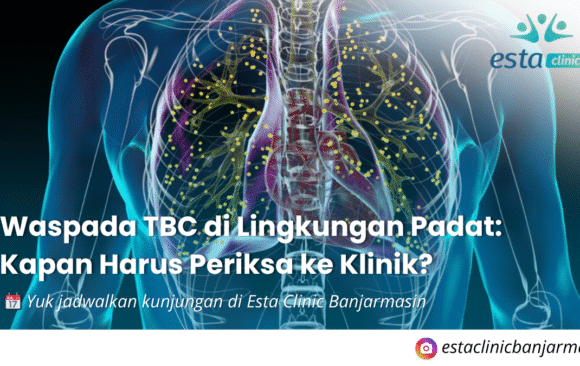 Kenapa Pemeriksaan Mata Rutin Penting, Meski Tidak Ada Keluhan (5) Waspada TBC di Lingkungan Padat: Kapan Harus Periksa ke Klinik?