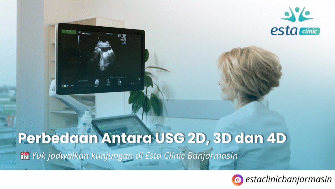 USG 2D, 3D, 4D & Fetomaternal: Pilihan Pemeriksaan Kehamilan di Banjarmasin