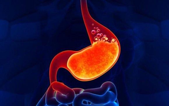 image Puasa Tanpa Asam Lambung Naik! 9 Tips Ampuh Berpuasa untuk Penderita GERD Agar Tetap Nyaman